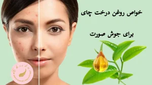 tee tree oil